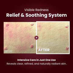 KOPHER Curepair Melder SOS Cream calms redness and irritation