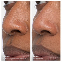 KORRES Santorini Grape bottle demonstrates salicylic acid unclogging pores