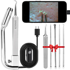 Kosimai Black Head Remover camera-front view showcases 1080p live preview for precise extractions.
