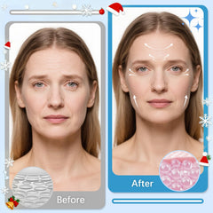 LadPemo smile-lines patches soften lines at mouth corners