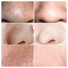 LANBENA blackhead strip papers illustrating strong absorption for cleaner pores