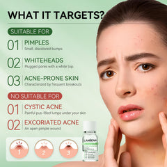 LANBENA serum texture closeup highlights lightweight, quick-absorbing formula for sensitive skin.