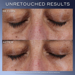 Lancôme Génifique Eye Cream application on skin for bright, even tone.