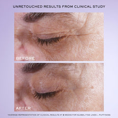 Lancôme Rénergie H.C.F. Triple Serum Eye application on under-eye highlighting fast-absorbing formula.