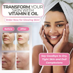 Leven Rose Vitamin E Oil on hair ends adds shine and moisture