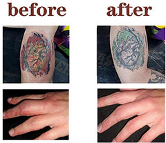 LIFETOOLS-LT textura hidratante: calma piel sensible tras el tratamiento