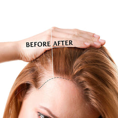 Luv Me Care Biotin Hair Growth Oil dropper highlighting precise dosing for scalp nourishment.