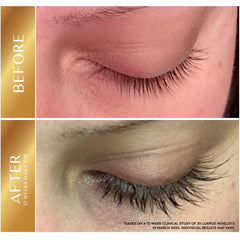 LUXROS serum applied along the upper lash line for precise, even conditioning