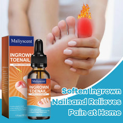 Maliyscent Ingrown Toenail Drop applicator tips ready for targeted application