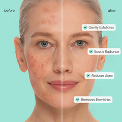 MAREE glycolic-acid-pad-surface-closeup emphasizes brightening texture.