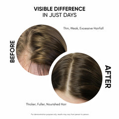 Masofta serum application on scalp shows simple massage for easy routine