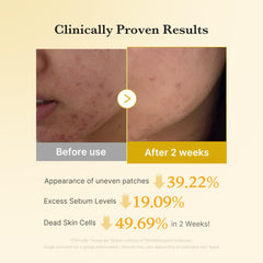 Medicube Kojic Acid Turmeric Toner Pad used on face and shoulders for smoothing.