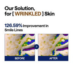 Mediheal Toner Pads in-use on the face for day and night care.
