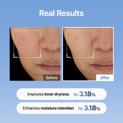 Meditherapy Hyaluronic Acid Serum XXL watery-texture highlights quick absorption for makeup-ready skin.