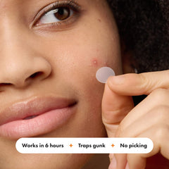 Mighty Patch Overnight adhesion on face stays through sleep for potential improvement