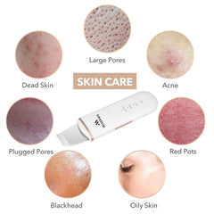 MISERWE Skin Scrubber white mode panel with four adjustable modes