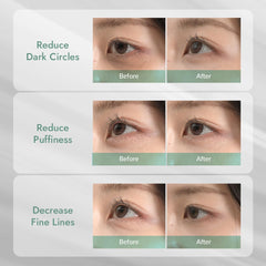 MIZON Cicaluronic 21-pairs travel pack emphasizes convenient, individually wrapped patches.