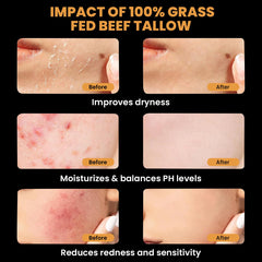 MONIER balm face application demonstrates gentle unscented care for sensitive skin