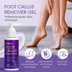 MOSRROU dual-sided callus remover shows coarse and fine surfaces for smoothing.