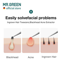 MR.GREEN needle-nose tips close-up for ultra-precision grooming