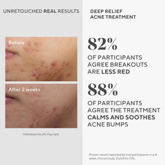 Murad Deep Relief packaging box highlights dermatologist developed formula.