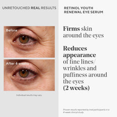 Murad eye serum packaging label highlighting gentle retinol formula for sensitive skin