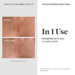 Murad Retexturizing Body Pads open pack flatlay emphasizes biodegradable, oil-free hydration with acids