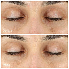 Murad Vita-C Eyes gold-stabilized vitamin C highlighting antioxidant support for brightness.