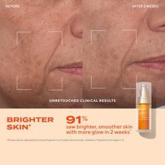 Murad Vita-C Glycolic Serum face application promotes even-toned, radiant skin.
