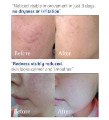 Nano Recipe ceramide concentrate boosts skin barrier in routine