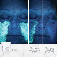 NassifMD Exfoliating Detox Pads wipes closeup – gentle exfoliation for smoother skin.