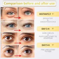 NAZANO under-eye patches with hyaluronic acid and collagen promote hydration.