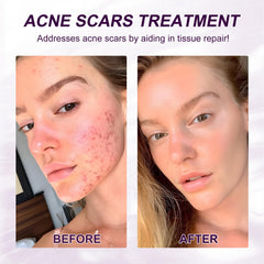 Netwik serum application scene for morning or night routine