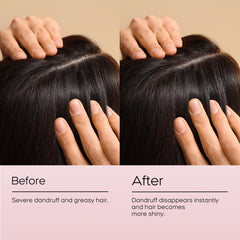NEWREY Angelica acutiloba root extract supports soothing scalp care
