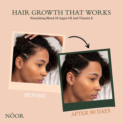 NOOR HAIR Growth Serum drop applicator showing easy daily use