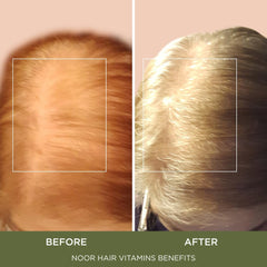 NOOR HAIR packaging front showing gluten-free and non-GMO claim