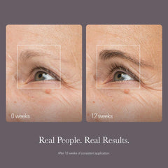 NULASTIN brow density progress visual indicating fuller appearance over time.