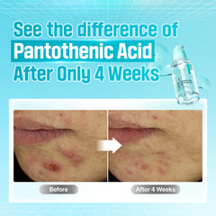 numbuzin No.1 serum ingredients pantothenic acid highlight oil-regulation action