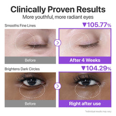 Numbuzin No.9 depuffing formula helps reduce under-eye puffiness
