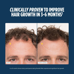 Man adding Nutrafol capsules to morning routine for consistent hair support