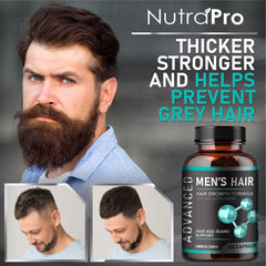 NutraPro capsules closeup highlights hair growth blend for thicker hair.