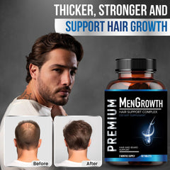 NutraPro MenGrowth tablet closeup highlighting hair growth capsules