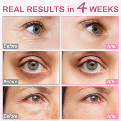 Omplen brightening under-eye visual indicating a more awake look.