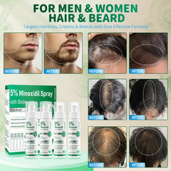 ONIADBA minoxidil spray applied to scalp to promote follicle stimulation.