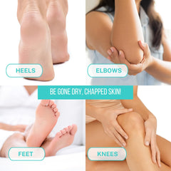 Onyx Professional dry feet care balm applying to rough skin