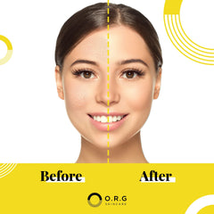 ORG Skincare exfoliated skin closeup demonstrates smooth texture after use