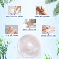 OUKEYA Urea Cream 40% hand cream moisturizes dry hands.