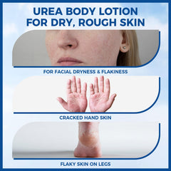 OUKEYA Urea Cream jar close-up showing creamy texture and fast absorption.