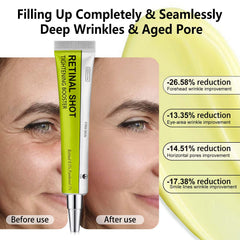 OVICISK Retinal Shot application shot illustrating gentle nightly use on the face.