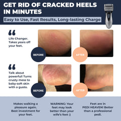 Own Harmony CR900 charging via USB for cordless foot care